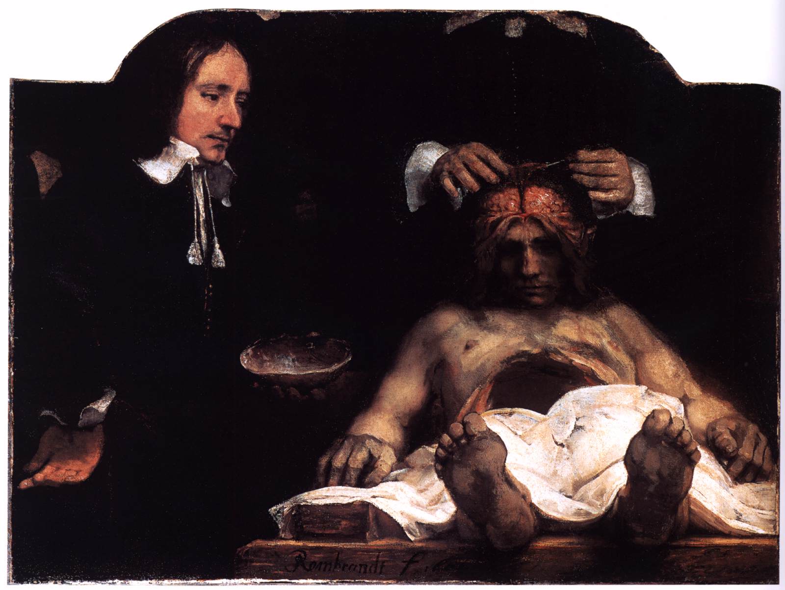 Lezione di anatomia di Joan Deyman
