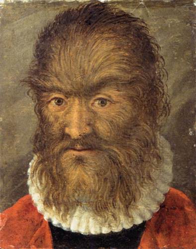 O Homem Peludo de Munique