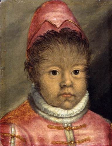 The Son of the Hairy Man of Munich