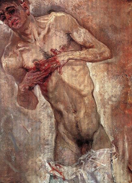 Bleeding - 1911